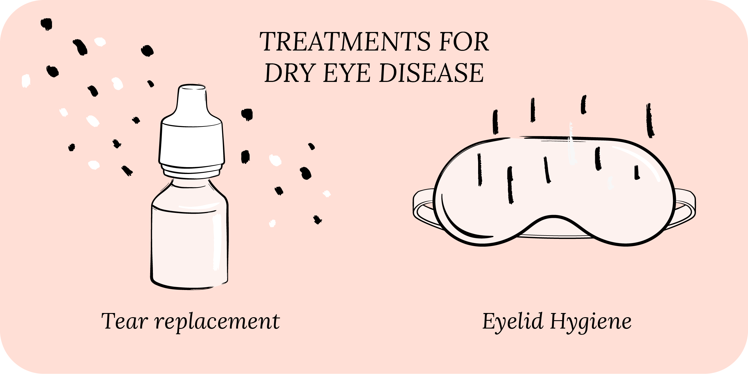 What are the best treatments for dry eye disease?