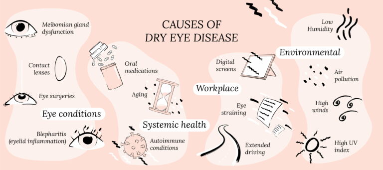 Different Types of Dry Eye Disease - CorneaCare