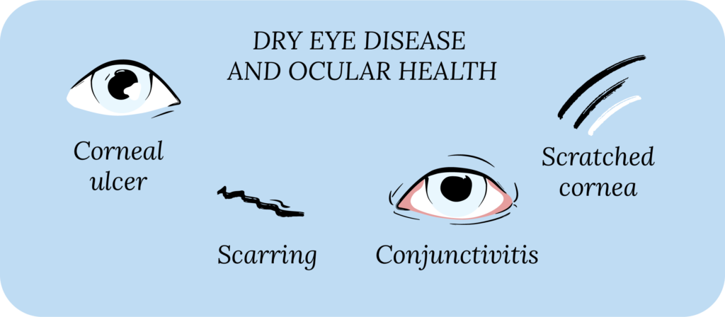 Dry eye disease and ocular health