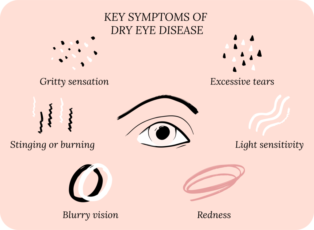 Does Dry Eye Cause Blurry Vision?