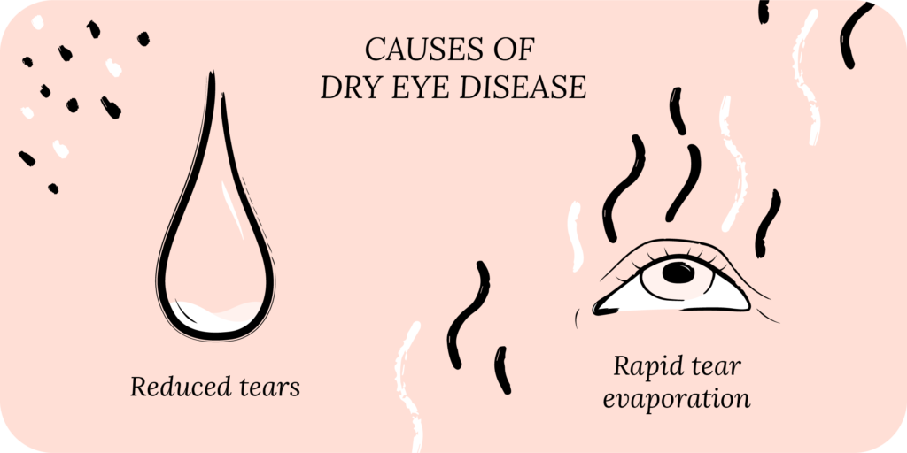 What causes dry eye disease?