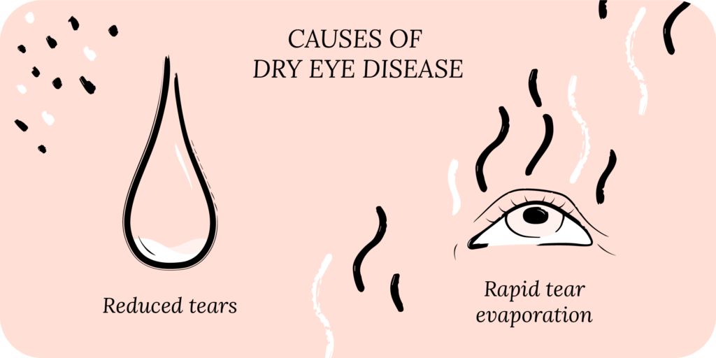 Causes of dry eye disease