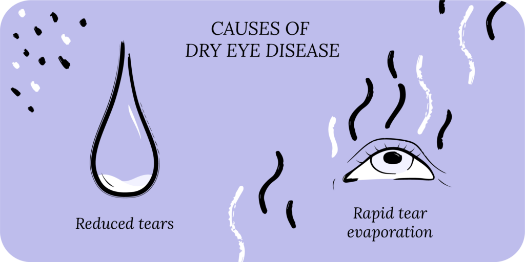 Causes of dry eye disease