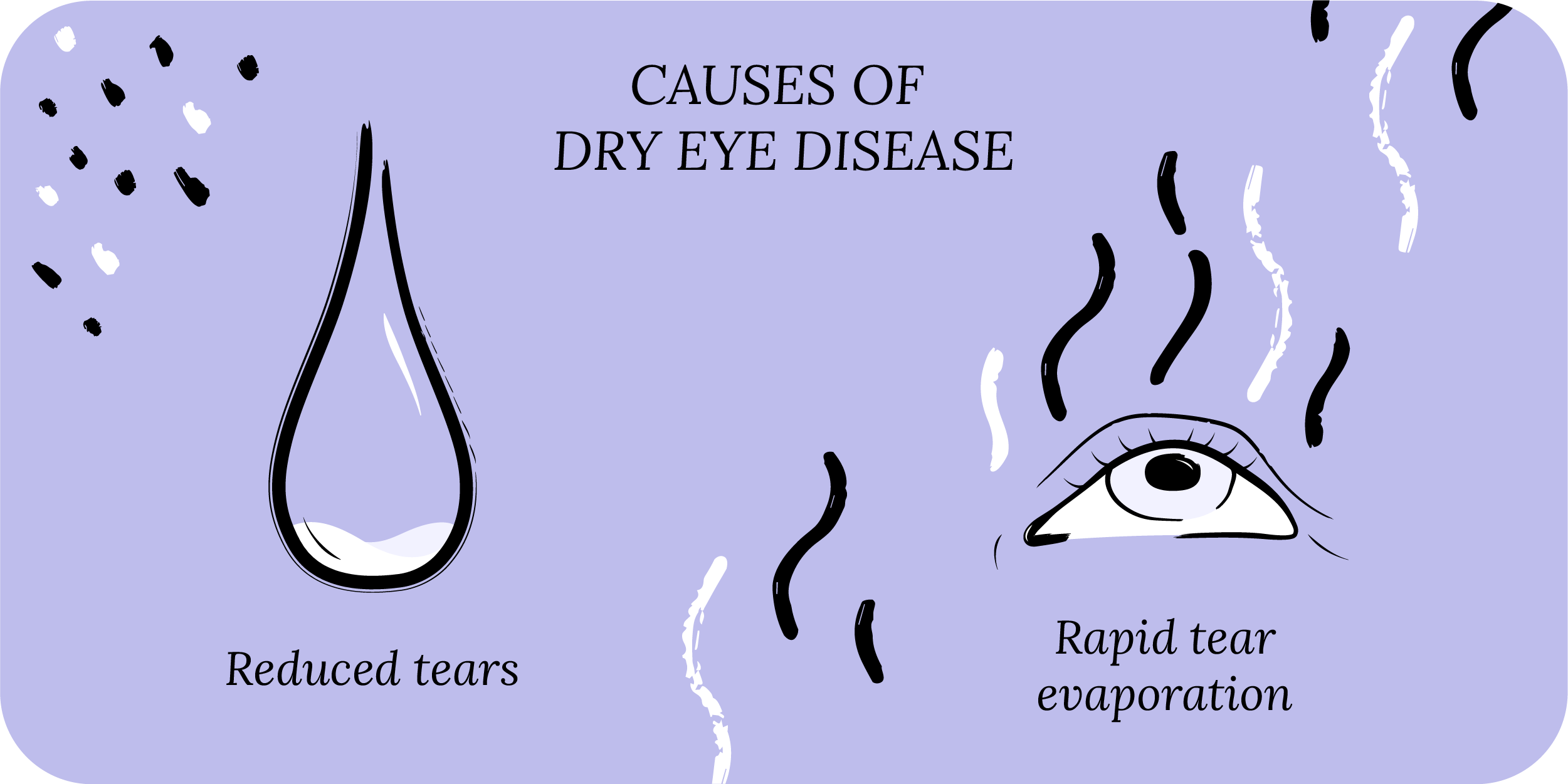 Causes of dry eye disease