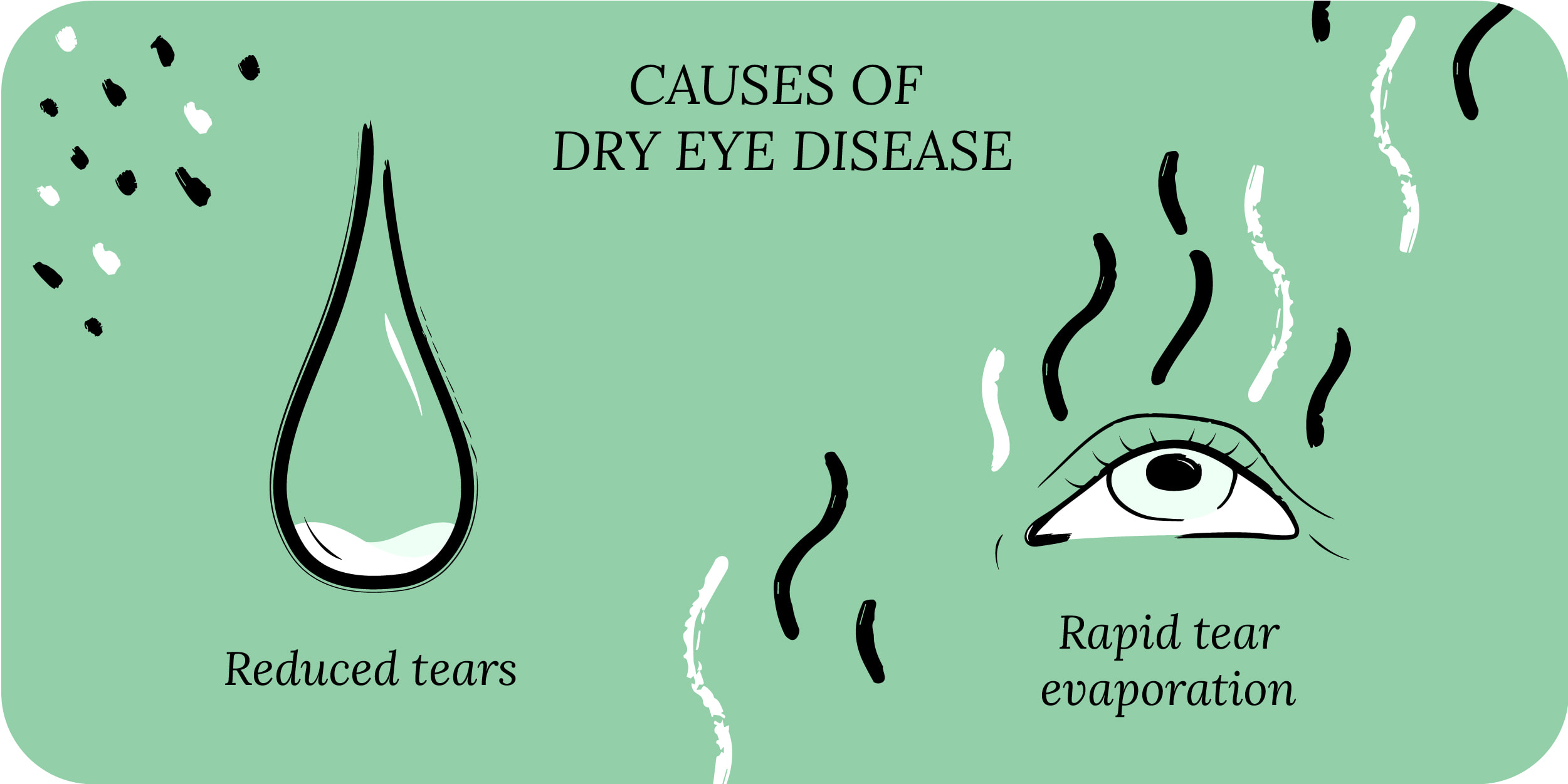 Causes of dry eye disease
