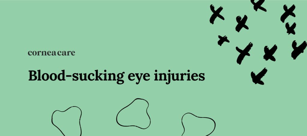 What to Do If You Get a Mosquito Bite on Eyelid