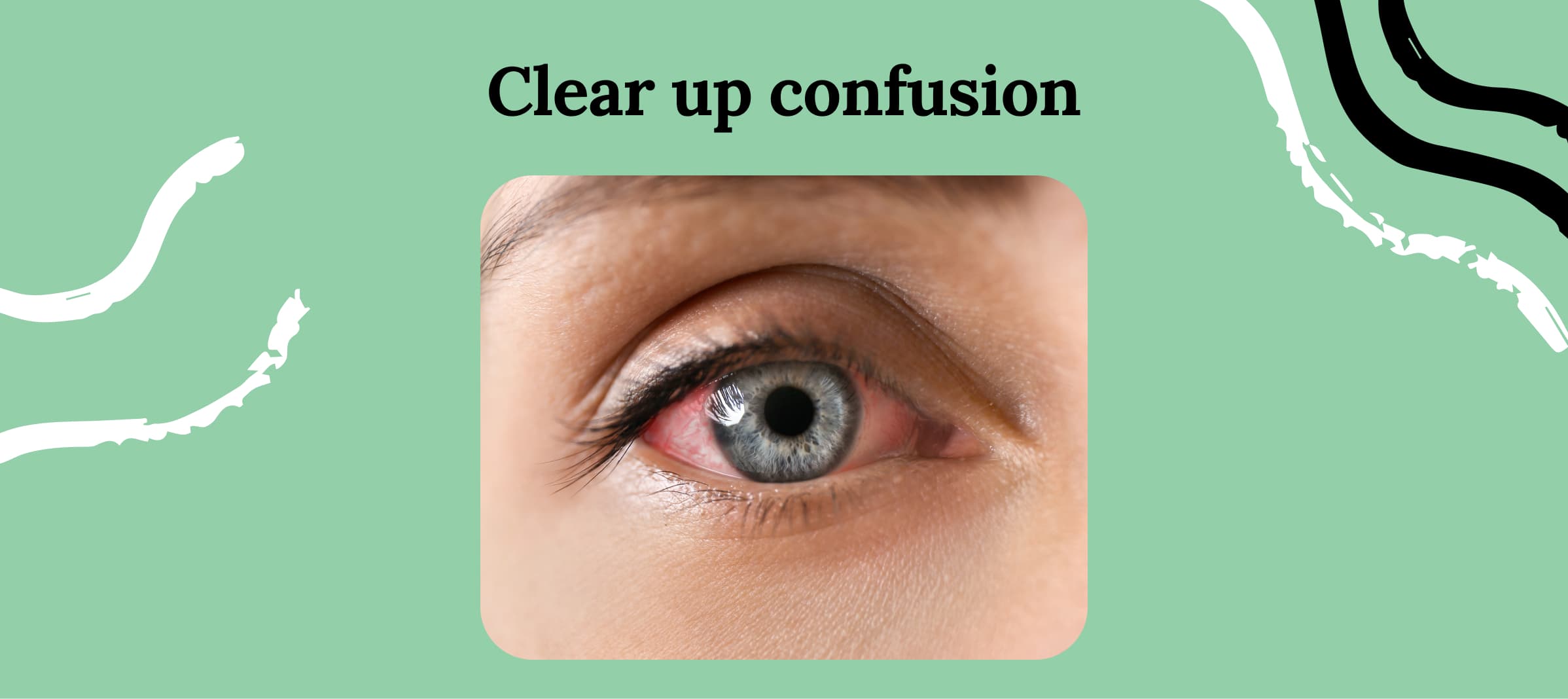 Allergy Eyes vs Pink Eye