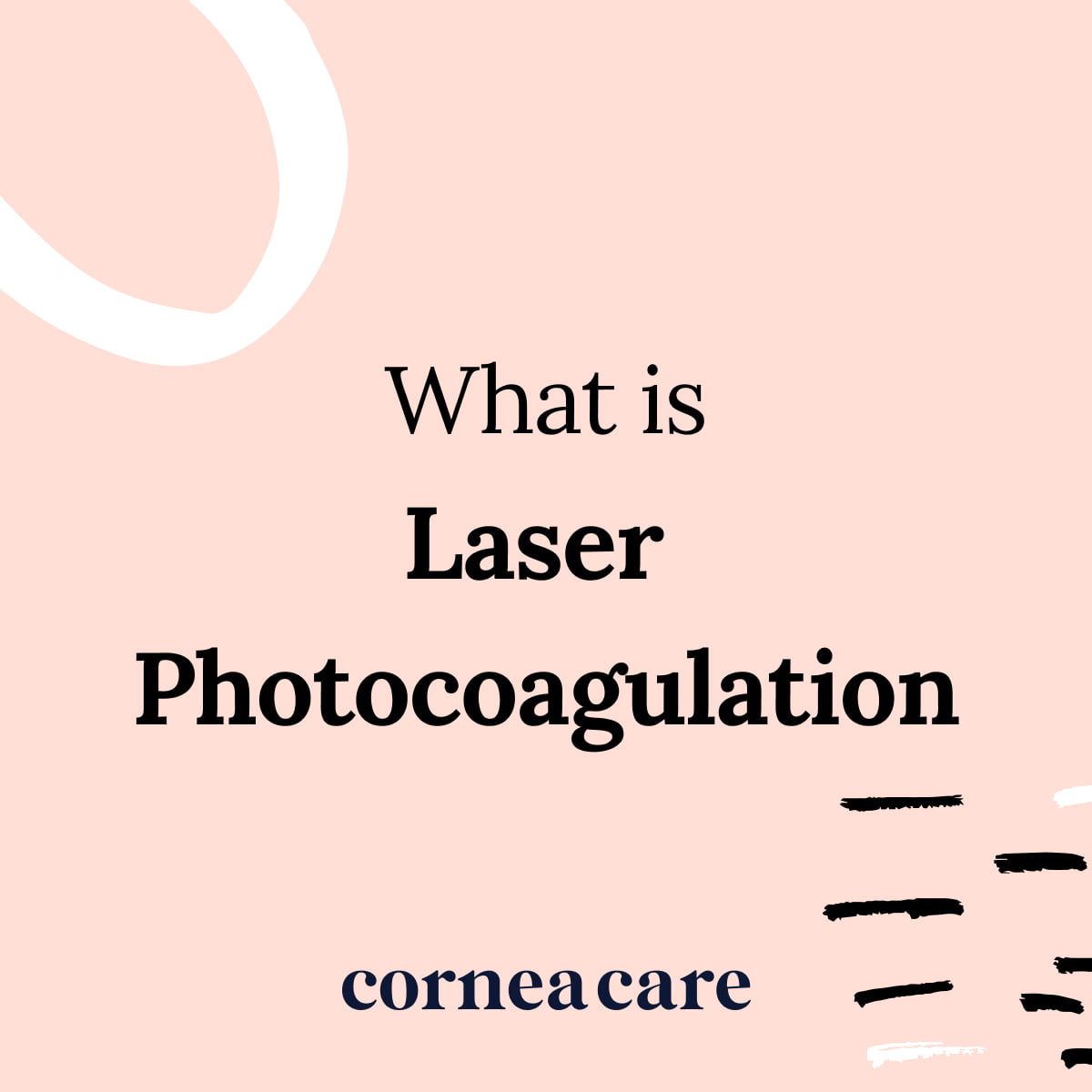 laser-photocoagulation-definition-corneacare