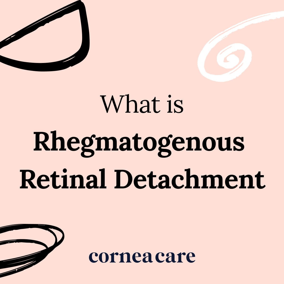 rhegmatogenous-retinal-detachment-definition-corneacare